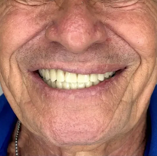 D3 Smile Transformation 2