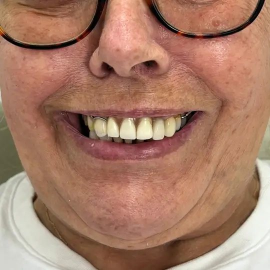 D3 Smile Transformation 8